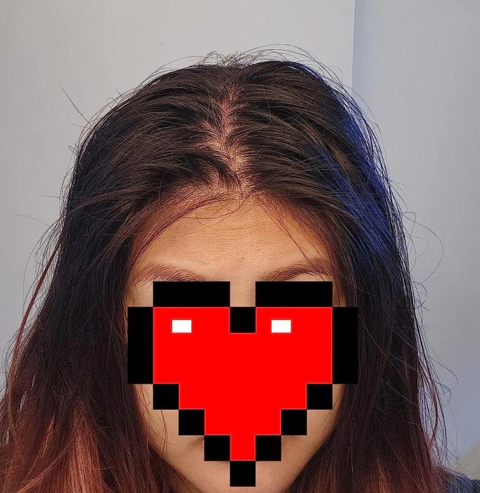 A reviewer’s greasy hair before applying the dry shampoo