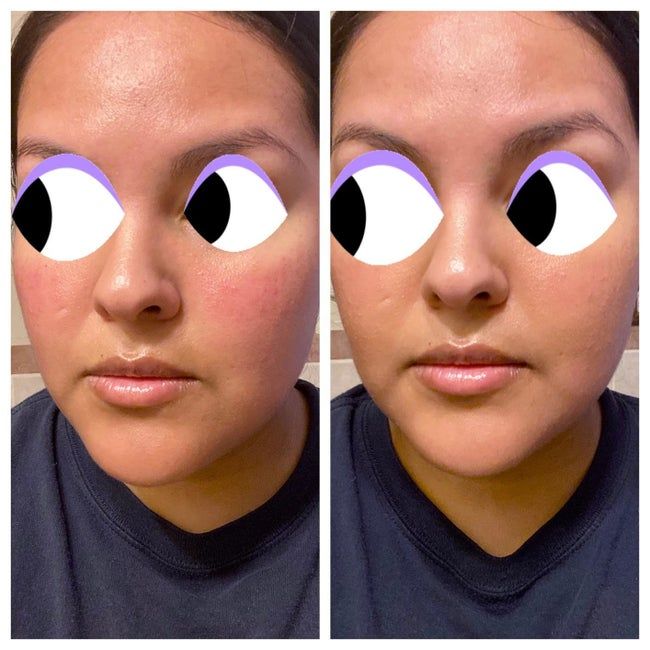 Reviewer wearing Maybelline Dream BB Fresh