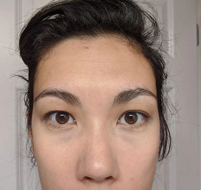 A reviewer’s photo showing the same person with the concealer applied