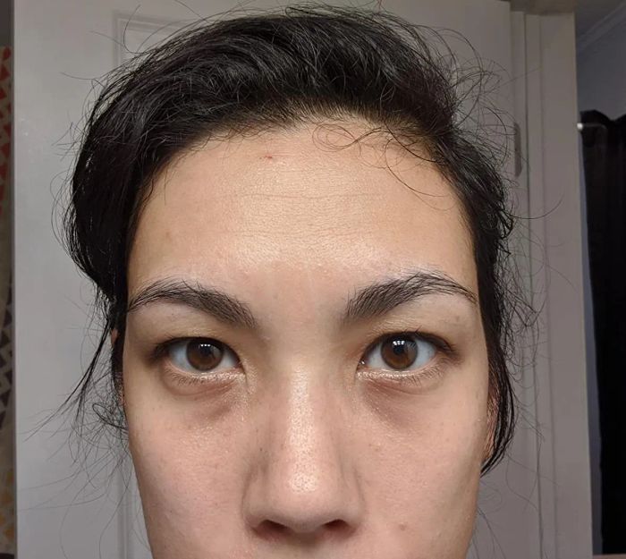 A reviewer’s photo before applying the concealer