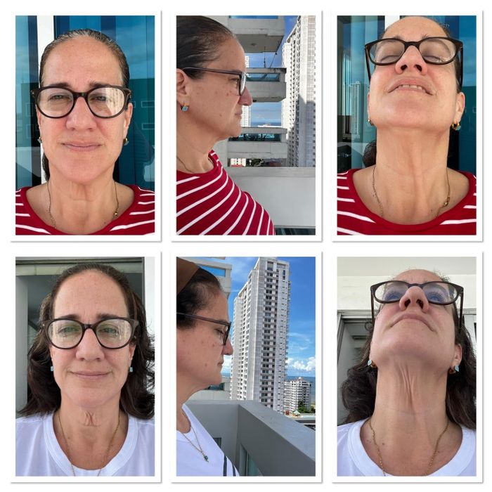 A six-photo collage showing a reviewer’s neck skin becoming firmer over time with regular use of the cream.