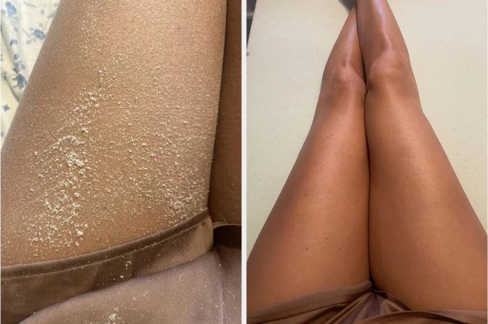 A close-up of a person’s legs showing the contrast between dry, flaky skin on the left and smooth, refreshed skin on the right.