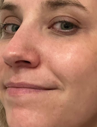 A close-up shot of a person’s face with a calm expression, highlighting a smooth and flawless skin texture.