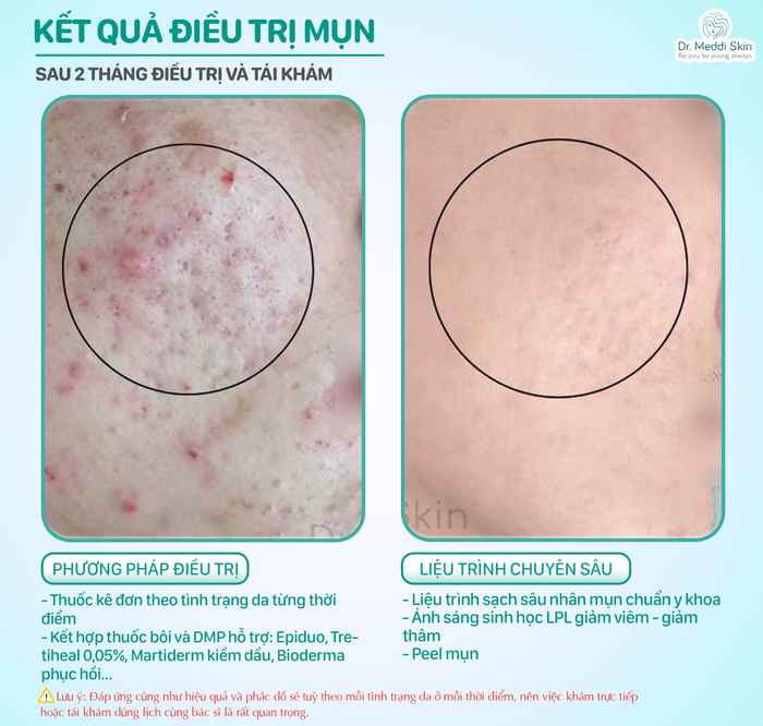 tri mun hcm 2.png