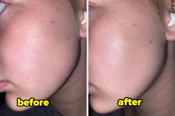 Side-by-side images showcasing significant improvement in skin texture, highlighting smoother skin on a person's cheek after using the toner. The left image shows the skin before, and the right one shows the glowing after effect.
