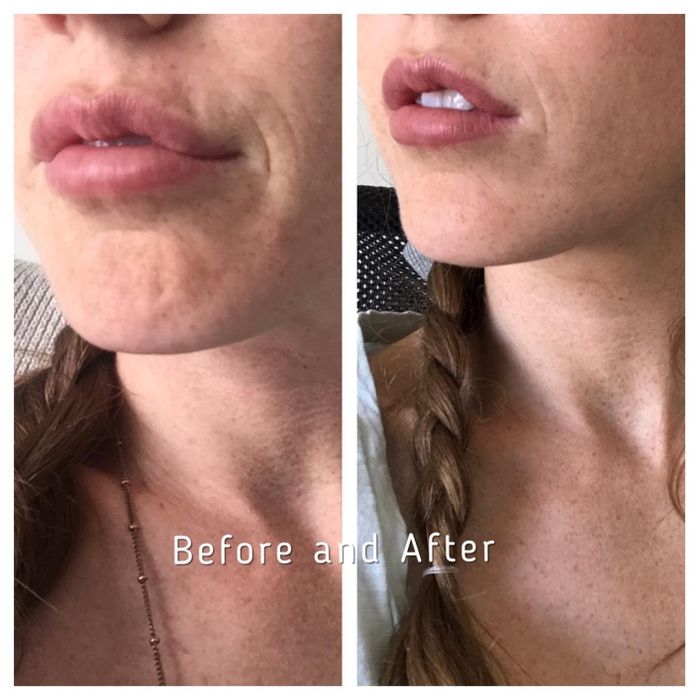 Close-up image of a reviewer’s lips before (left) and after (right) using a skincare product, showing noticeable improvement in skin texture and appearance after use. Text: