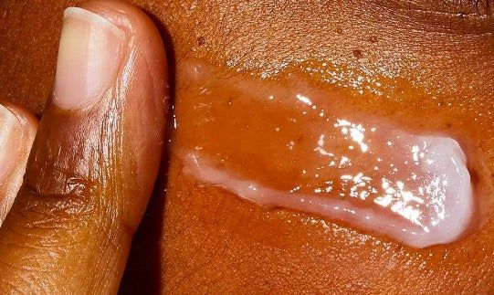 A close-up of fingers gently applying a transparent skincare product to someone's skin.