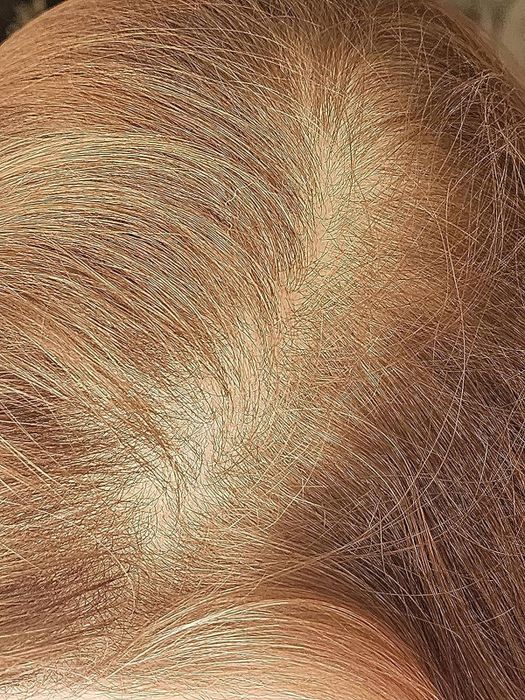 A reviewer's after photo using the dry shampoo powder.