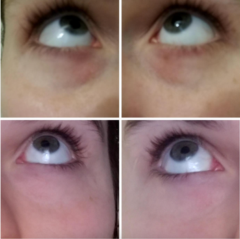 A before-and-after picture of a reviewer with dark under-eye circles that vanish in the second image.