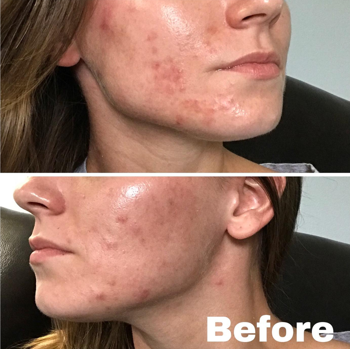 The reviewer’s skin before using the Mizon cream.