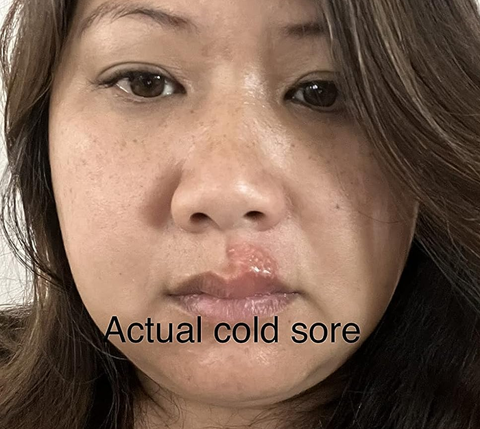 A reviewer with a cold sore on their upper lip