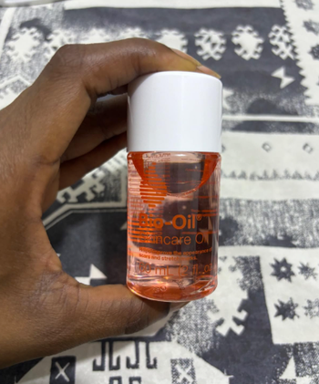 A hand holding a small bottle of Bio-Oil Skincare Oil, a popular solution for reducing the appearance of scars and stretch marks. The background features a white and patterned design.