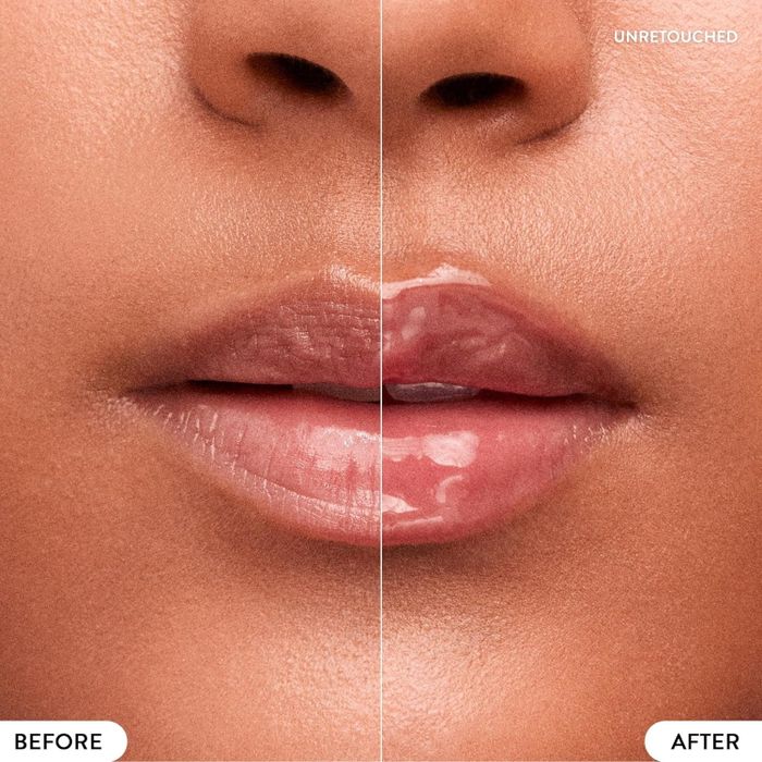 A close-up of a person’s lips showing a side-by-side comparison, with labels indicating the before and after effects