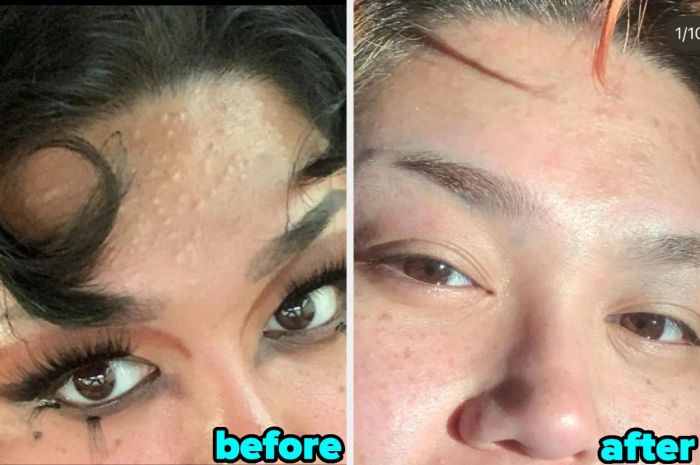 A close-up split image showing the transformation of skin: the left side has visible texture, labeled