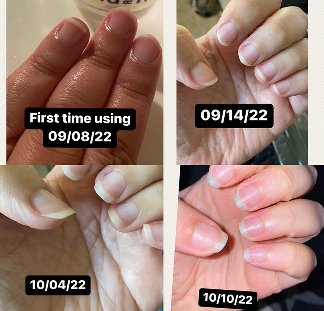 A series of photos showing a reviewer's nails growing longer and stronger after using the nail strengthening cream.