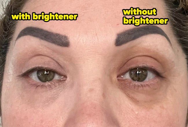 Close-up of a person with eye brightener applied to the left eye, and without it on the right.