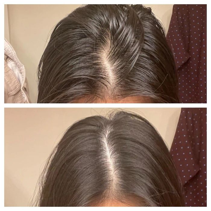 Two close-up shots of a reviewer’s head, showing the comparison of their hair before and after using the treatment.