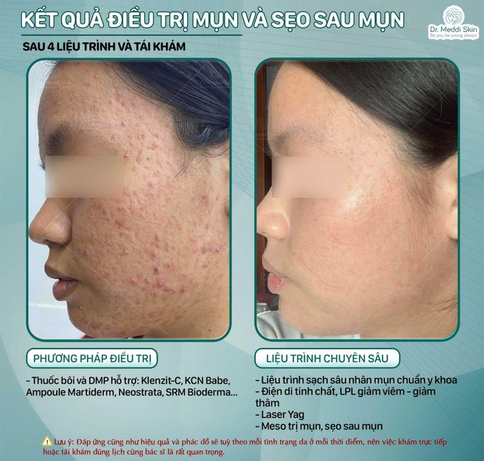 tri mun hcm.jpg