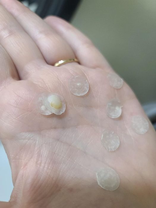 A hand holding seven used skincare product patches, one displaying white residue, demonstrating their effectiveness.