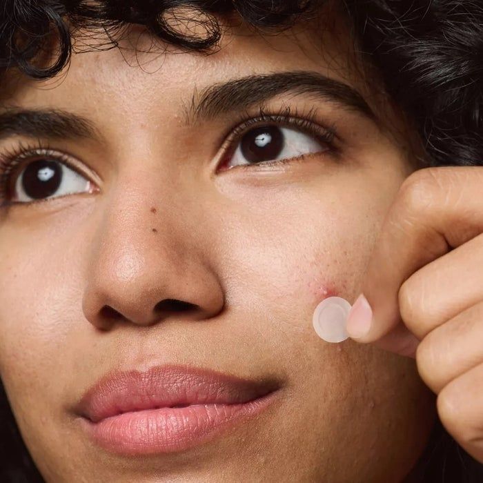 Close-up of a model applying an acne patch to her cheek