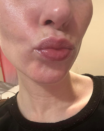 A close-up of a person's glossy lips with a slight pout.