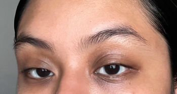 A close-up of a person's face focusing on their eyebrows and eyes, showing natural skin texture.