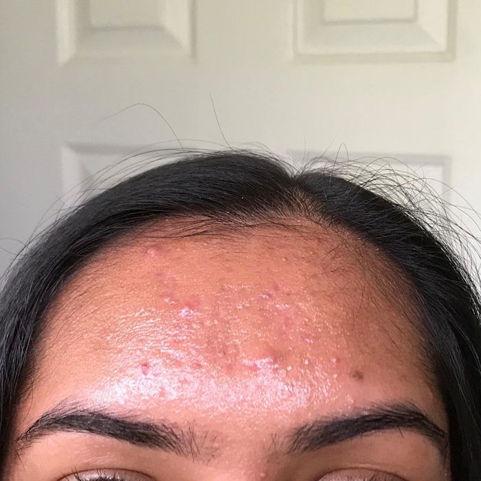 A reviewer's forehead covered in oil.
