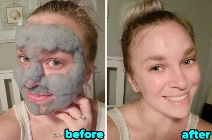 A reviewer’s before and after shots using the bubbly face mask