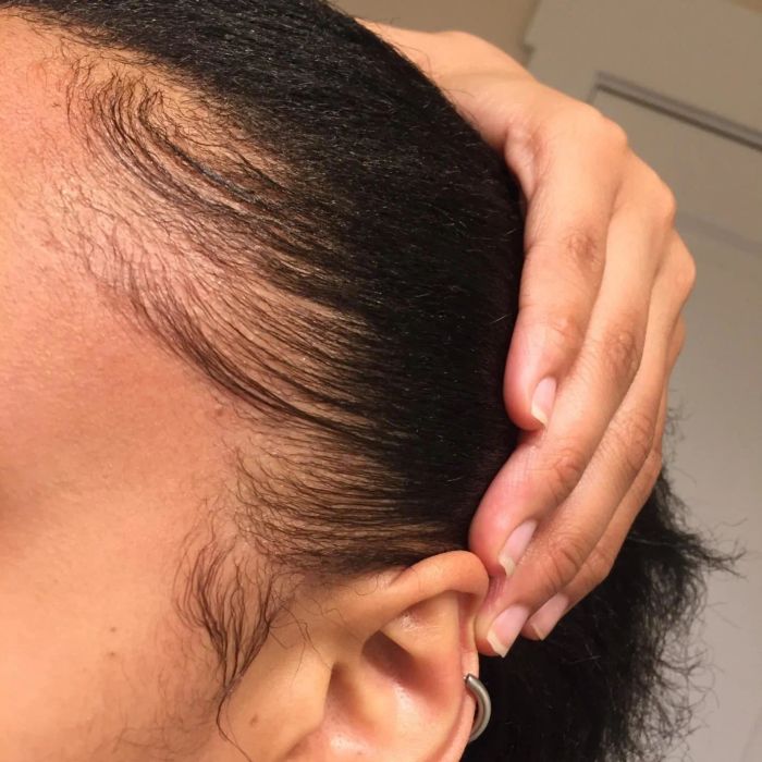 after shot with hair neatly slicked back and laying flat