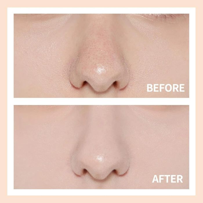Before and after shots showing a nose with noticeable pores, followed by smooth skin, demonstrating the effects of the skincare product