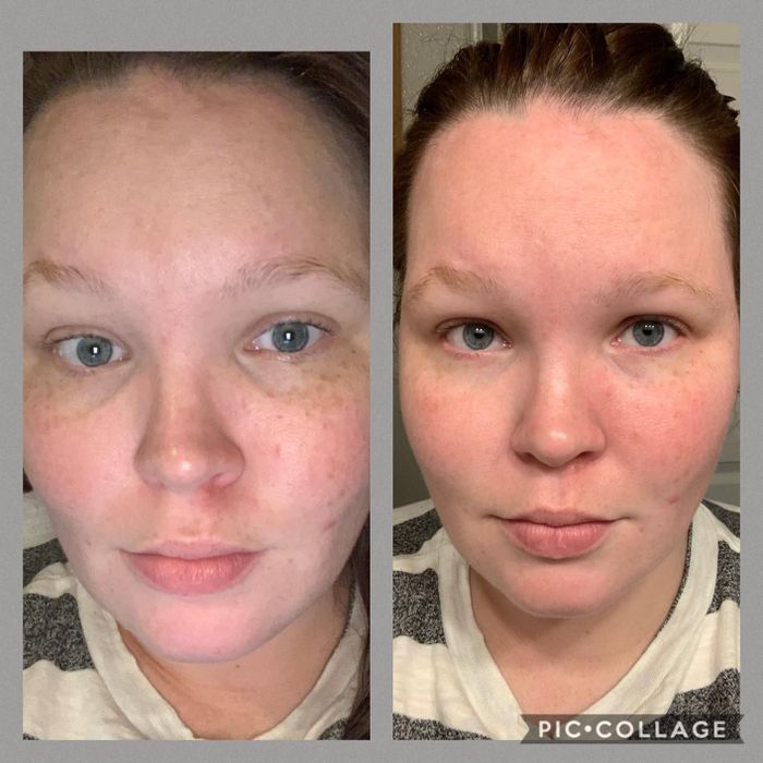 A reviewer's before and after shots showcasing noticeable improvements in dark circles after using the eye masks