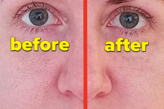 A reviewer applying the pore filler on half their face, demonstrating how it blurs large pores.