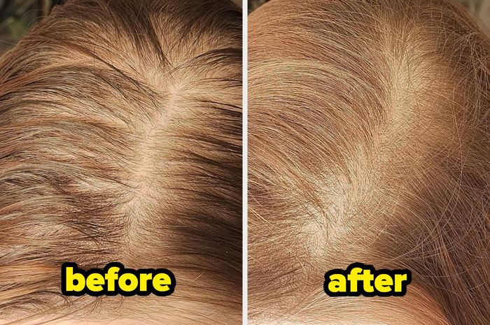 Before image of a reviewer's oily hair followed by an after image showing refreshed, oil-free hair