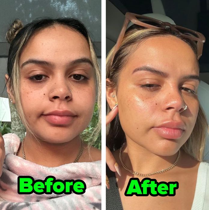 The reviewer's under-eye area before and after applying the eye cream, showing visible improvement.