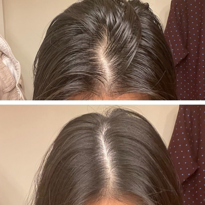 A before-and-after image of the reviewer's greasy hair before using the dry shampoo, followed by their refreshed and clean hair after the treatment.