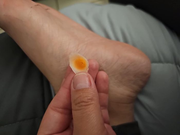 A close-up of a hand holding a small corn that has been removed, positioned in front of their foot