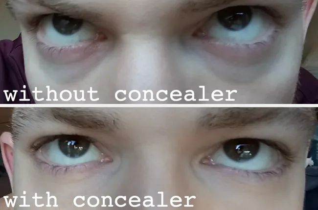A reviewer showing off their under-eye bags with a label to highlight the area