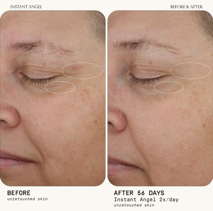 A close-up comparison showing skin before and after 56 days of using Instant Angel cream, with visible improvements