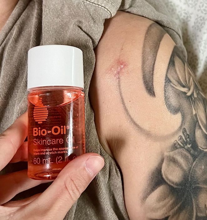 Another reviewer holds a bottle of Bio-Oil near a scar, showing how it’s helping to diminish its appearance.