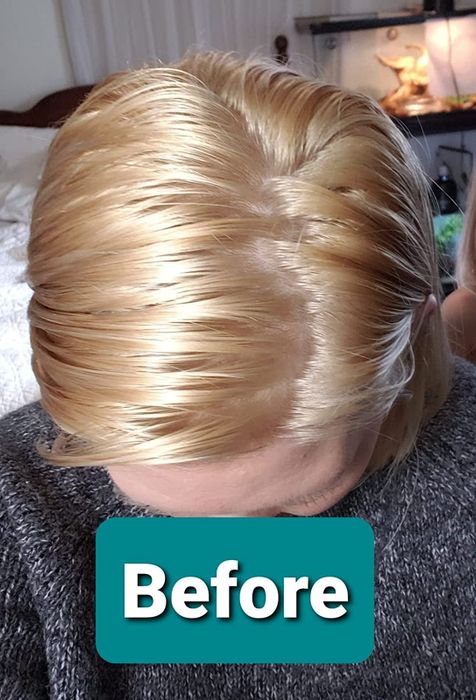 A before photo showing a reviewer's greasy roots.