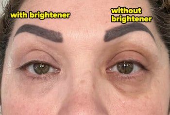 Close-up of a person with eye brightener on the left eye and without it on the right