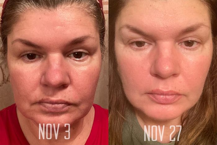 Side-by-side comparison of a reviewer's face showing skincare results from Nov 3 to Nov 27.
