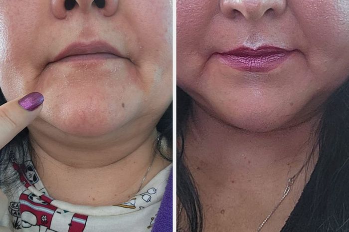 A reviewer showing before and after images, with dry skin concealed by the primer and foundation coverage.