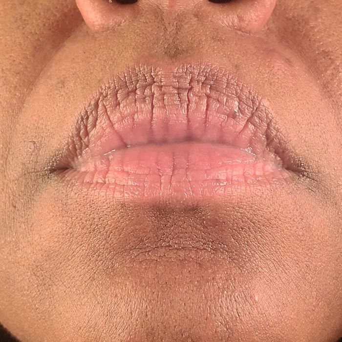 After photo of the same reviewer with all the hair removed