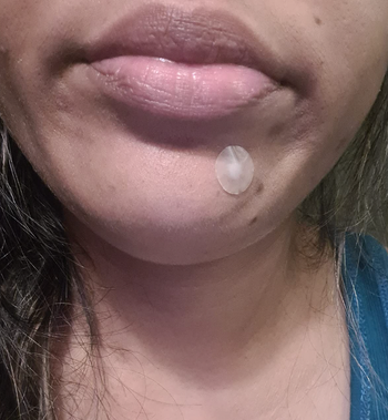 Reviewer applying a small round sticker to treat a blemish