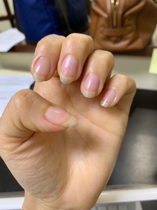 The same reviewer’s after photo showing nails that are now stronger and longer