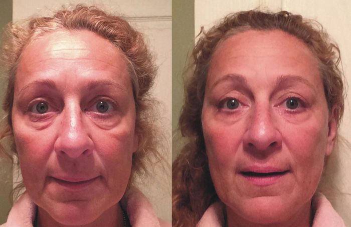 Before-and-after photos of a reviewer using the serum, showing their skin looking visibly lifted with wrinkles and fine lines appearing less noticeable.