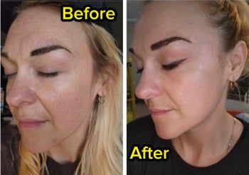 Side-by-side close-up of the reviewer's face, showing the transformation before and after using snail mucin