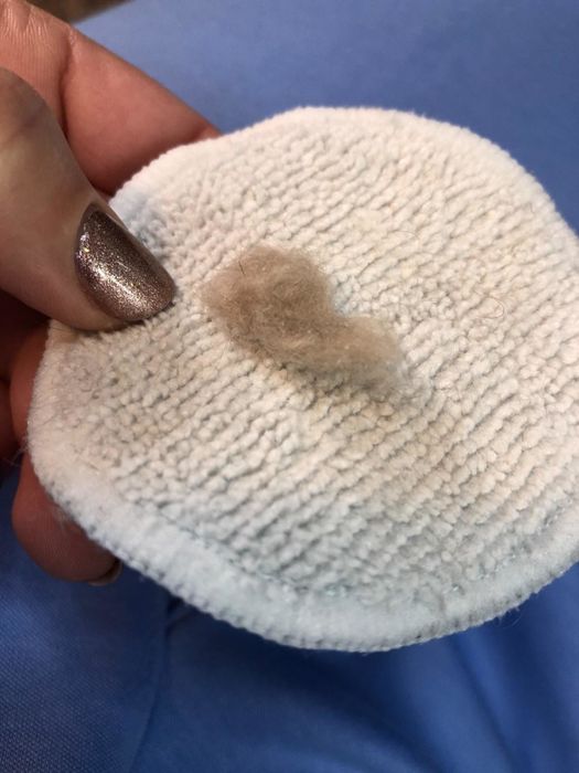 Another reviewer holding a cotton pad with a sizable ball of peach fuzz they shaved off their face