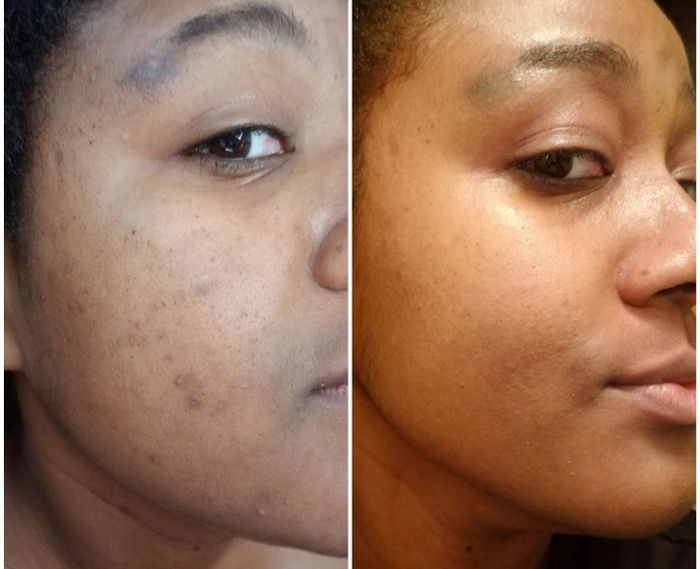 Reviewer shows before and after, highlighting how the mask made their skin feel firmer and helped smooth out some wrinkles.